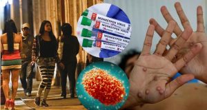 La Viruela del Mono se transmite por relaciones sexuales Fase Eruptiva. Las lesiones y ampollas recién son visibles en esta segunda etapa del virus Mpox.